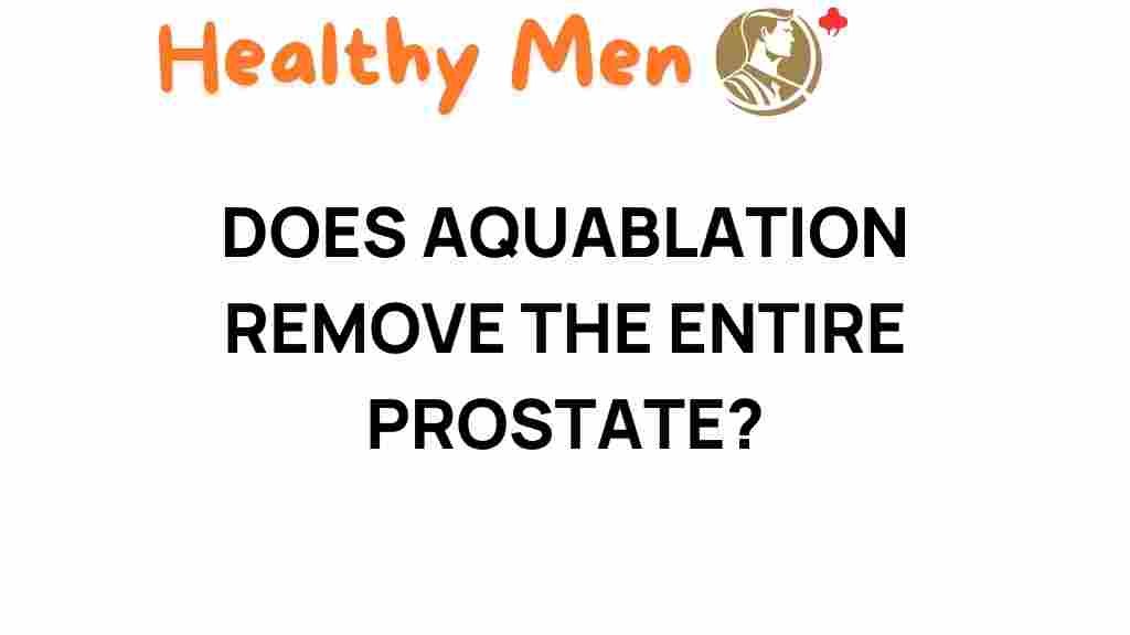 aquablation-remove-entire-prostate