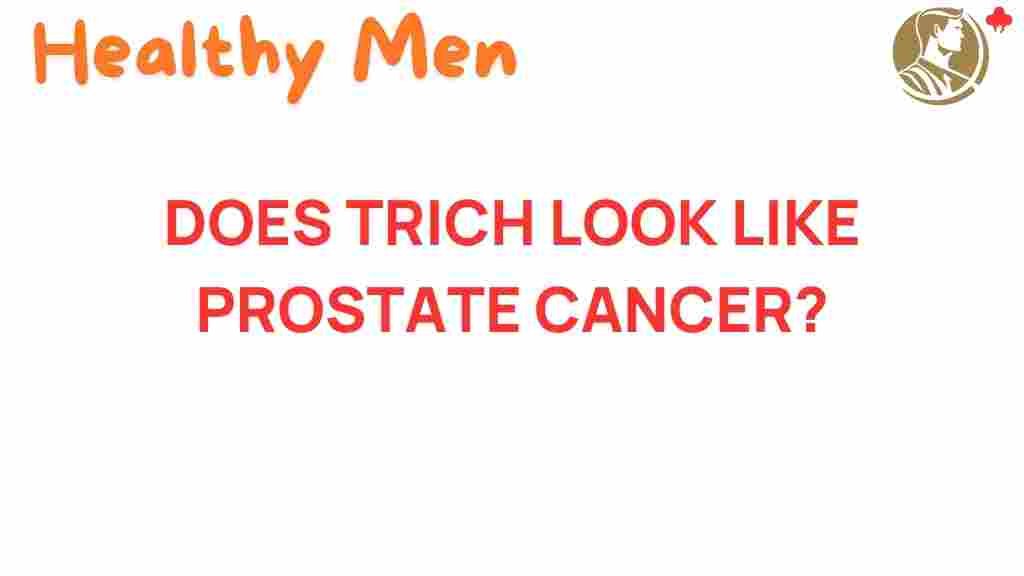 trichomoniasis-prostate-cancer